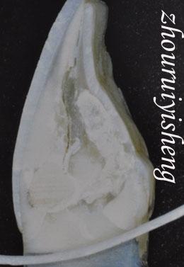 舌隆突的结构我们有没有思考过舌侧观很常见的一个误区其实就差那么