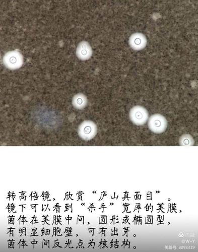 新型隐球菌