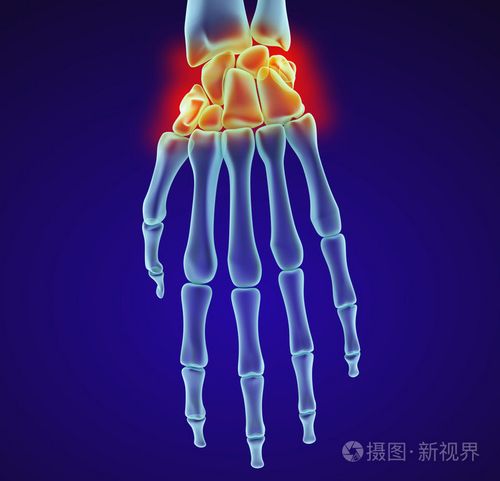 人类的腕关节解剖.x 射线视图.医学上准确的 3d 图