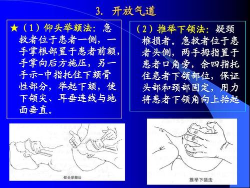 开放气道 ★(1)仰头举颏法:急 (2)推举下颌法:疑颈 救者位于患者一侧