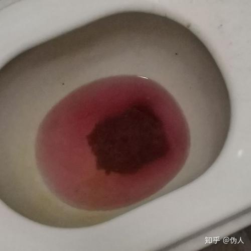 为什么早上吃的红心火龙果晚上就拉红色的大便了?