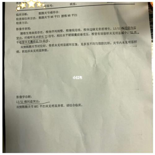 l5s1椎间盘突出_医疗健康_医疗健康其他