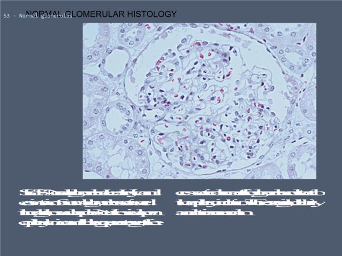 糖尿病肾病的病理观察 .ppt
