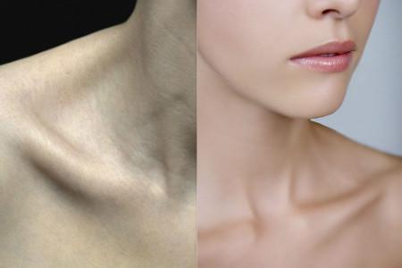 左边锁骨下方隐痛是怎么回事 几个病因你要知道