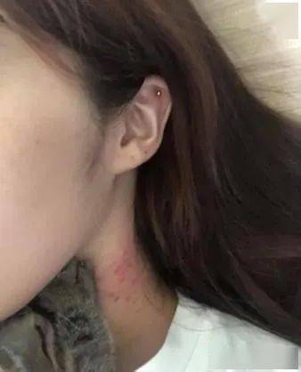 小猫看到肉肉就开吸,结果她的脖子被种满草莓!