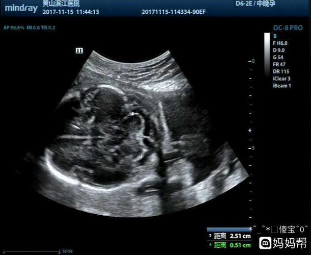 发个四维让你们帮我看看男宝女宝            