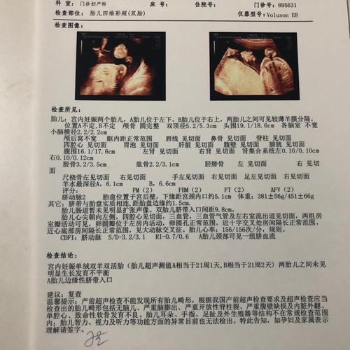 22周双胞胎四维彩超顺利通过～_胎儿_四维彩超_胎盘_双胞胎_妊娠_产科