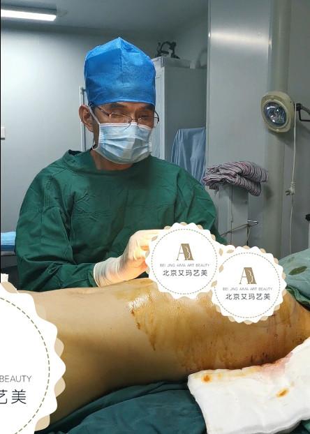 浓缩丰胸真实案例am096 项目分类:胸部整形 隆胸 自体