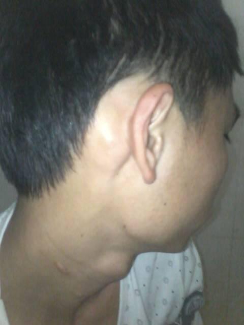 耳背后面都有突出来骨头,别人又没有,,这