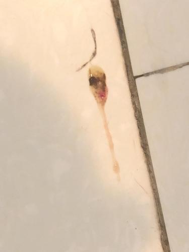 【讨论】猫咪两次拉血了,我买的驱虫药还在路上请问这是.