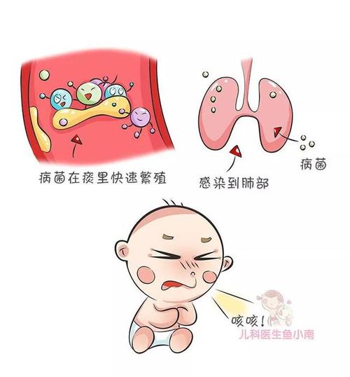 原创辟谣!咳咳咳,宝宝久了会咳成肺炎,医生:这5种咳声一定要注意