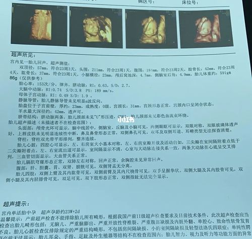 四维检查三次,猜一下男孩女孩_四维彩超_母婴_孕产经验