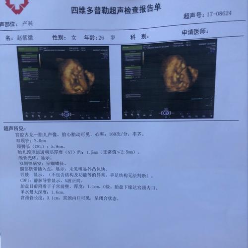 怀孕三个月想知道是男孩女孩 好奇嘿嘿有谁知道吗