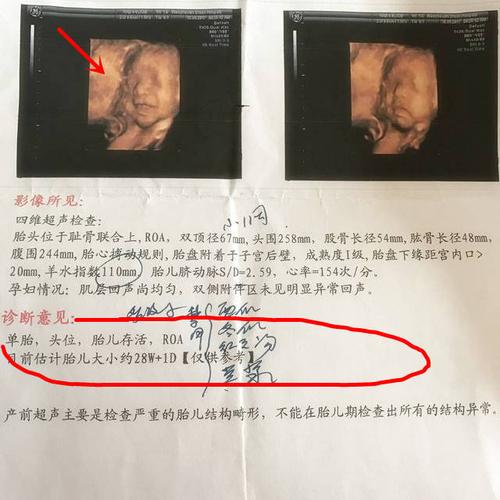 孕28周 ,四维b超宝宝在笑,瞬间融化了