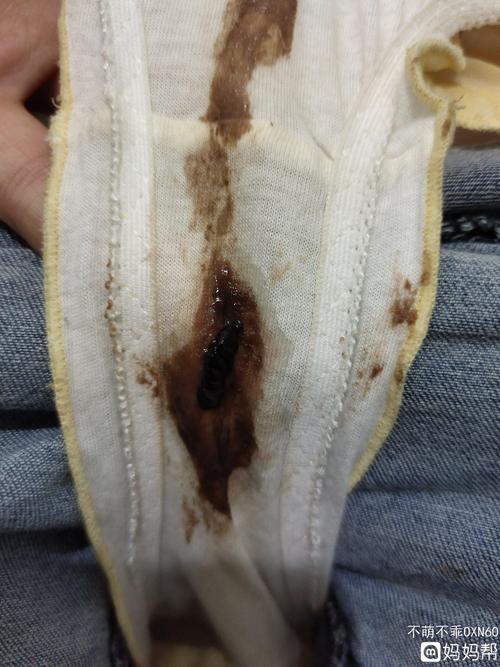 排卵期排出褐色的东西好几天了排卵试纸