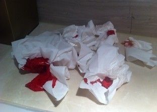 唐嫣被曝半夜送医院急诊 手部出血浸透多重纱布