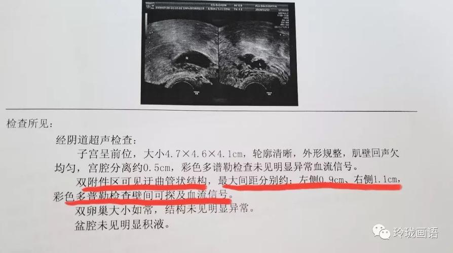 教你看懂妇科b超报告超级干货来啦
