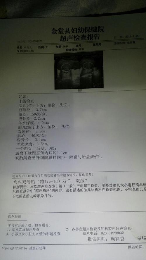我也是双胞胎四个月了