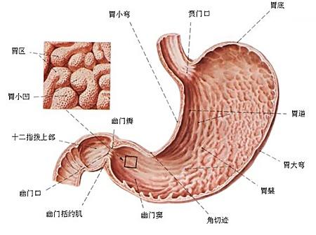胃穿孔症状,胃溃疡与胃穿孔的区别