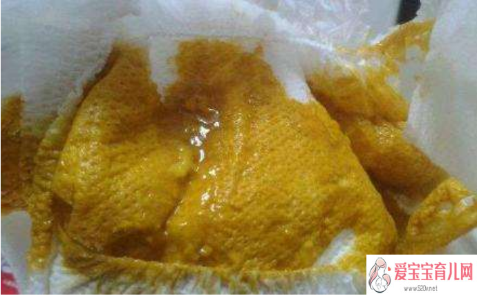 婴儿如果大便太干,排便困难,可用蜂蜜适量代替白糖放于奶中喂食,大便