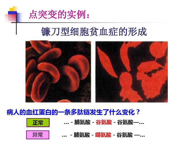 基因突变重组与检测技术ppt  点突变的实例: 镰刀型细胞贫血症的形成