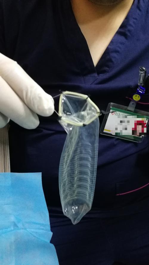 后决定将避孕套缝到圈套器上,增加避孕套口的硬度,增大成功几率.