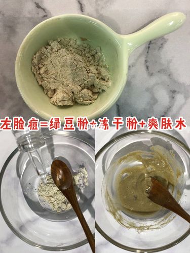 自制超有效中药面膜7515拯救痘痘肌7515排毒祛痘收毛孔60