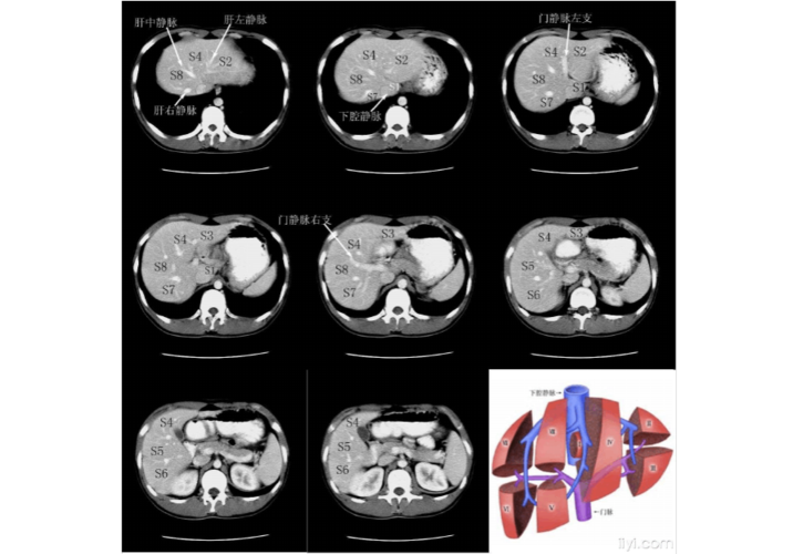 肝脏分段学习