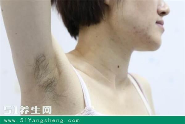 腋毛上的黄色分泌物是没洗干净?小心生大病