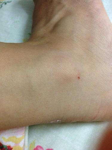 被两个月不到的小狗磨牙磨出了一个伤口.自己都没意识