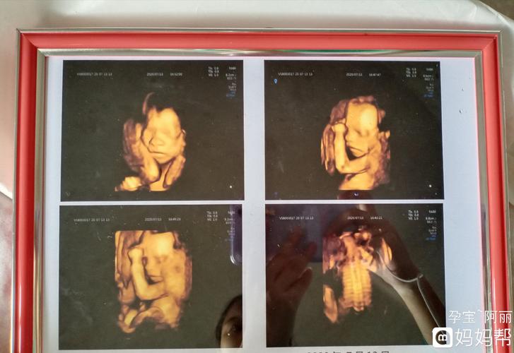 五个月做了四维彩超,胎儿长一斤.