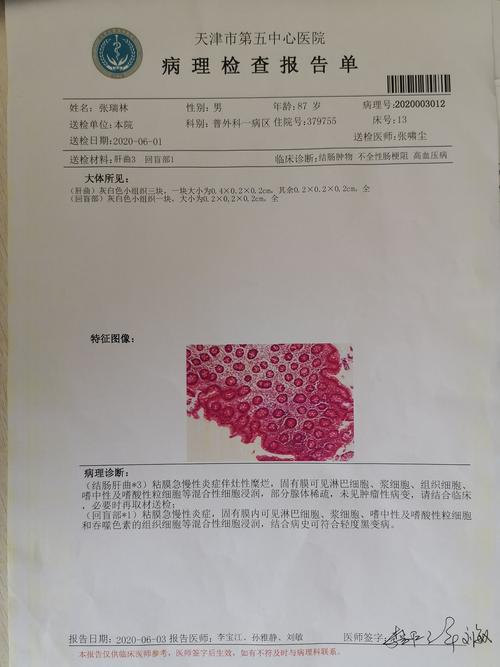 患者腹部强化ct延迟期 已向家属交代病情,高度怀疑升结肠癌,但没有