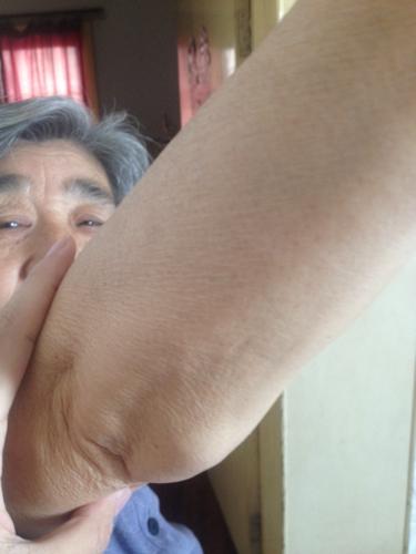 好几年了.也不痛