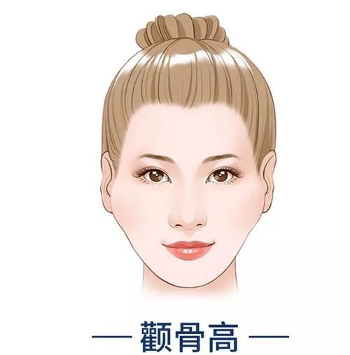 颧骨高适合做线雕吗?会把脸拉宽吗?
