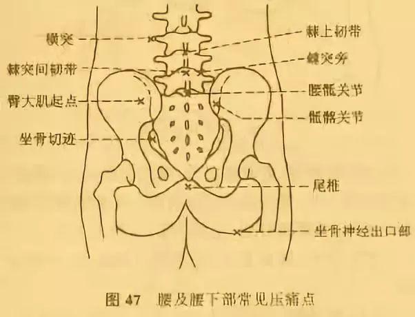 同时,含胸,驼背,压力更多的集中在下背部,产生腰骶和骶髂区域的疼痛