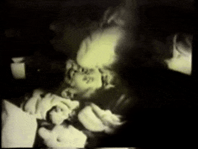 83天的核事故救治,他看着自己的身体腐烂成一具活尸