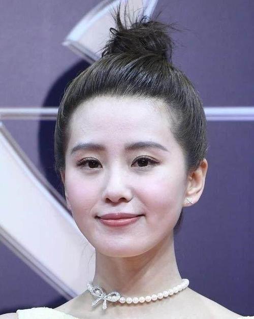 刘诗诗梳着丸子头,十分有型,但侧面鬓角头发稀疏,露出大片头皮,看起来