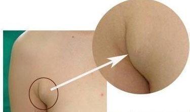 网易首页>正文申请入驻> 这里,首先要澄清许多女性认为自己有"副乳"跟