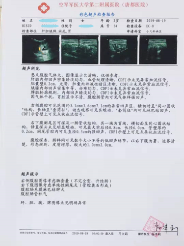 入院后复查腹部超声提示升结肠部肠套叠加重,阑尾炎,阑尾腔粪石,,于
