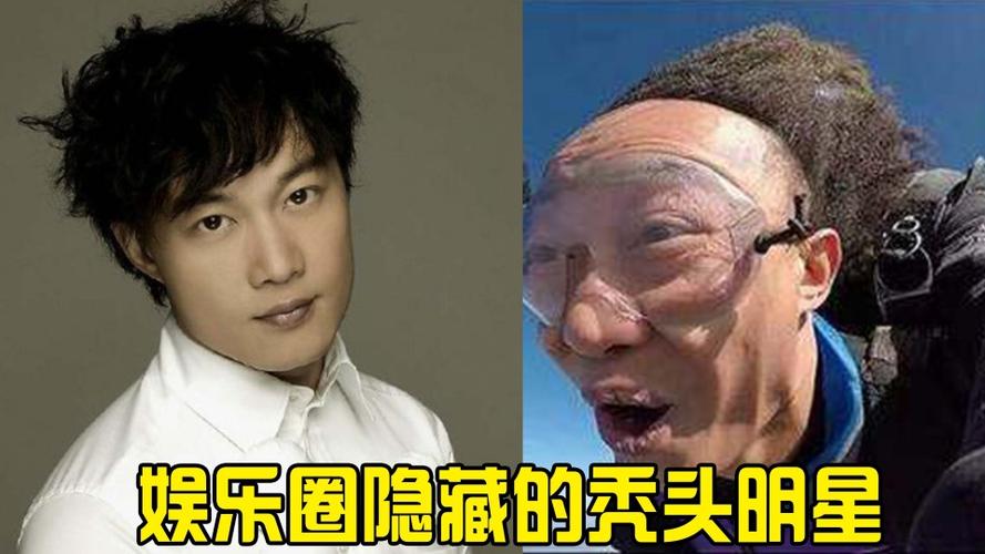 娱乐圈隐藏的秃头明星黄晓明植被稀疏王一博千玺变寿星公