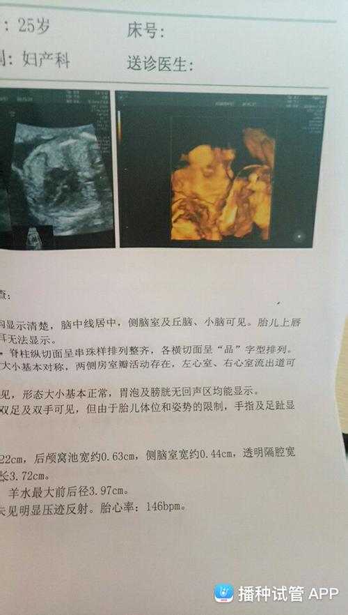 [试管婴儿]24周啦.宝宝6个月啦.