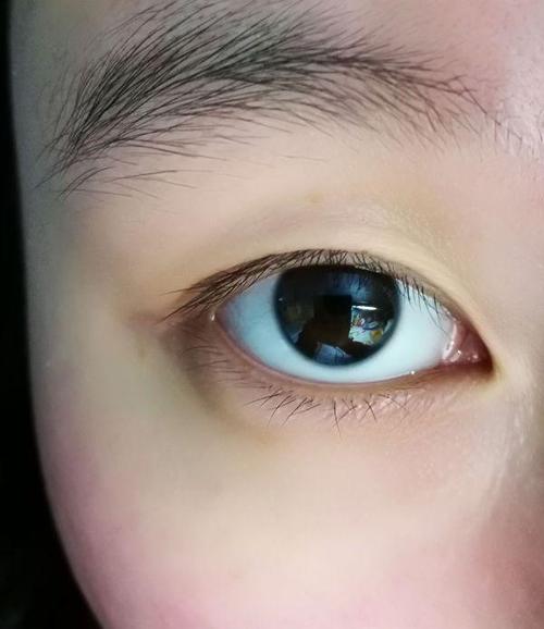 人死时瞳孔会放大,如果当时凶手被死者看到的话,他的身影会留在死者