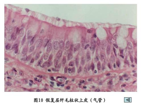 假复层纤毛柱状上皮(气管)