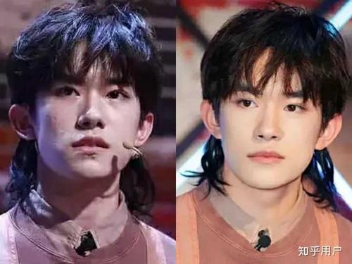 有哪些明星有颌面问题?比如地包天?