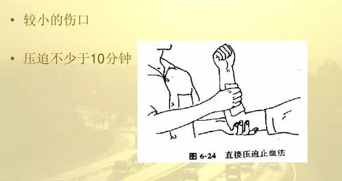 近心端动脉指压动脉止血已严重危及生命出血达1000毫升以上时伤者可能