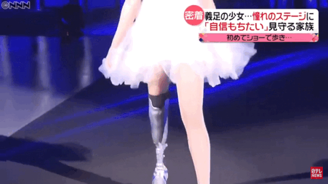 日本18岁美少女不幸截肢模特梦想的她如今戴上义肢重返舞台无数人泪崩