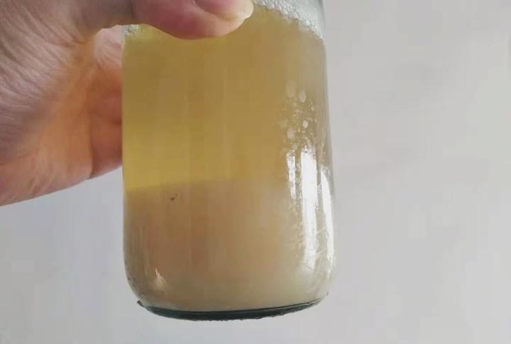 曹志明大夫提示:尿液是肾功能的试金石,3种变化是肾病