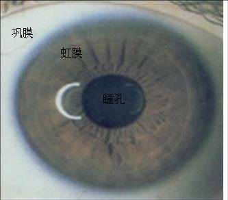 展开全部 白色 巩膜 褐色 虹膜  黑色 瞳孔 向左转  向右转