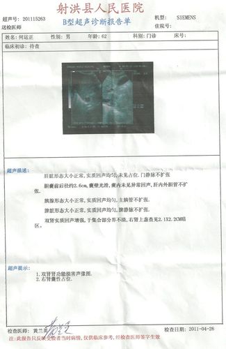 肾囊肿用哪种方法治疗效果好