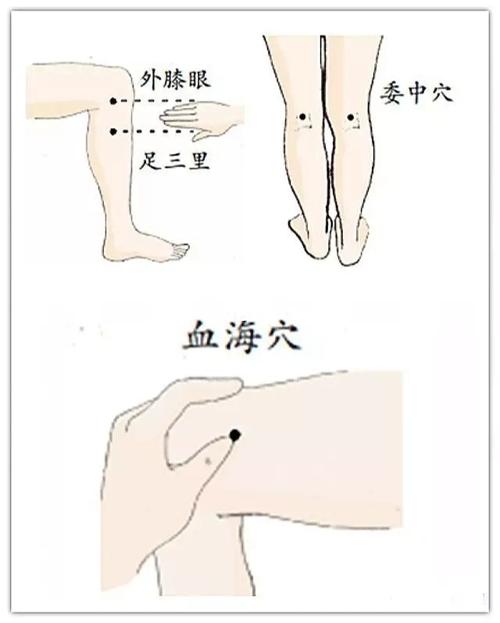 膝关节积液疼痛可以用艾灸,也可以针灸_艾灸_医疗健康